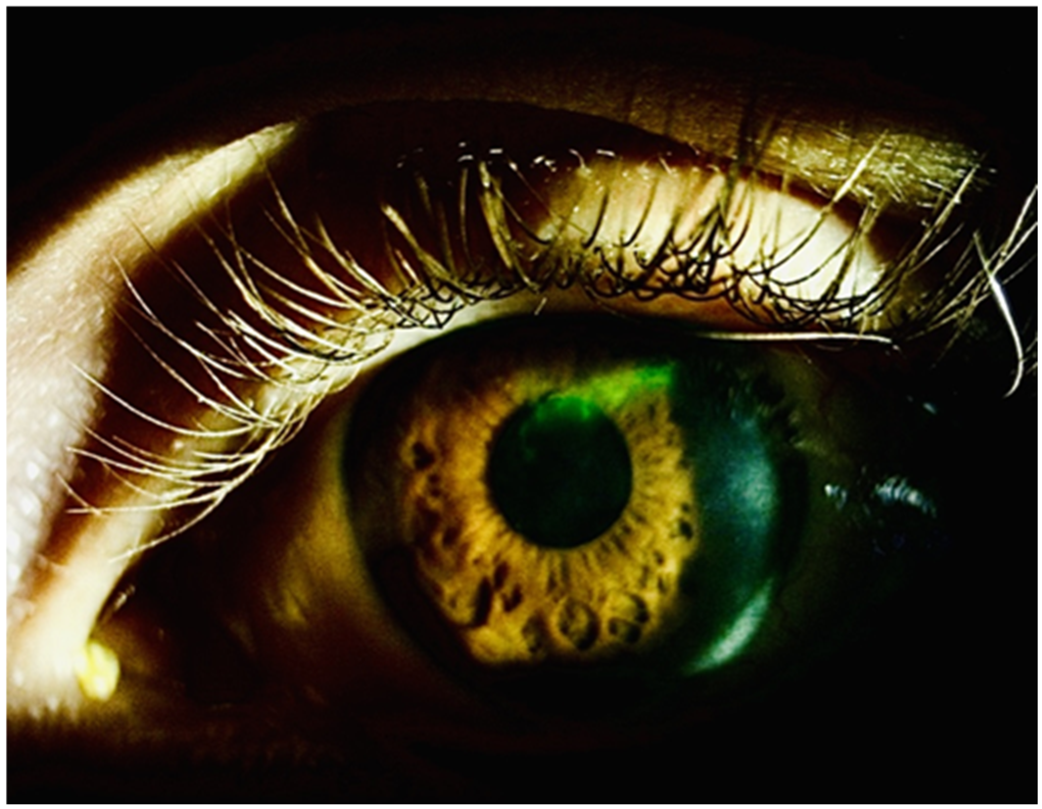 Vision 09 00063 g002