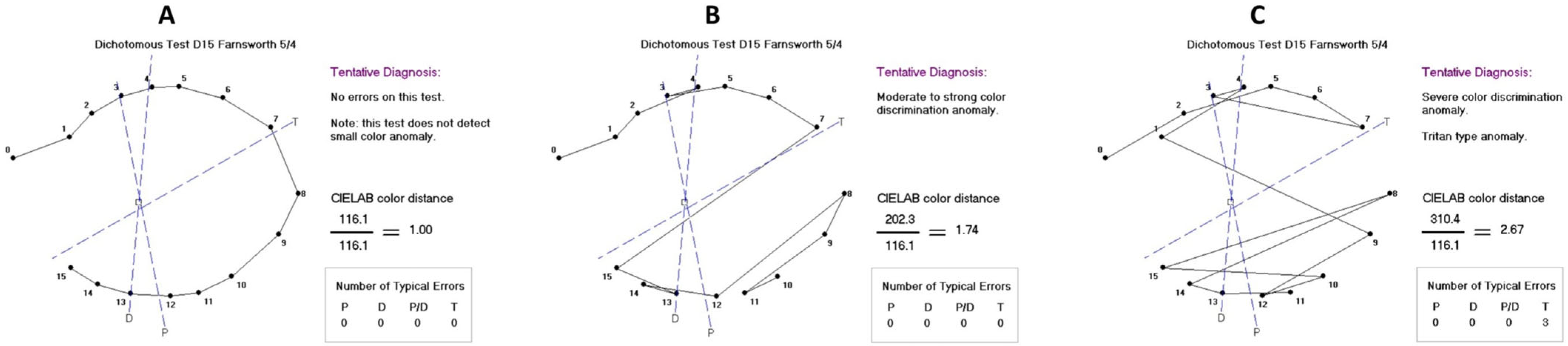 Vision 09 00070 g001