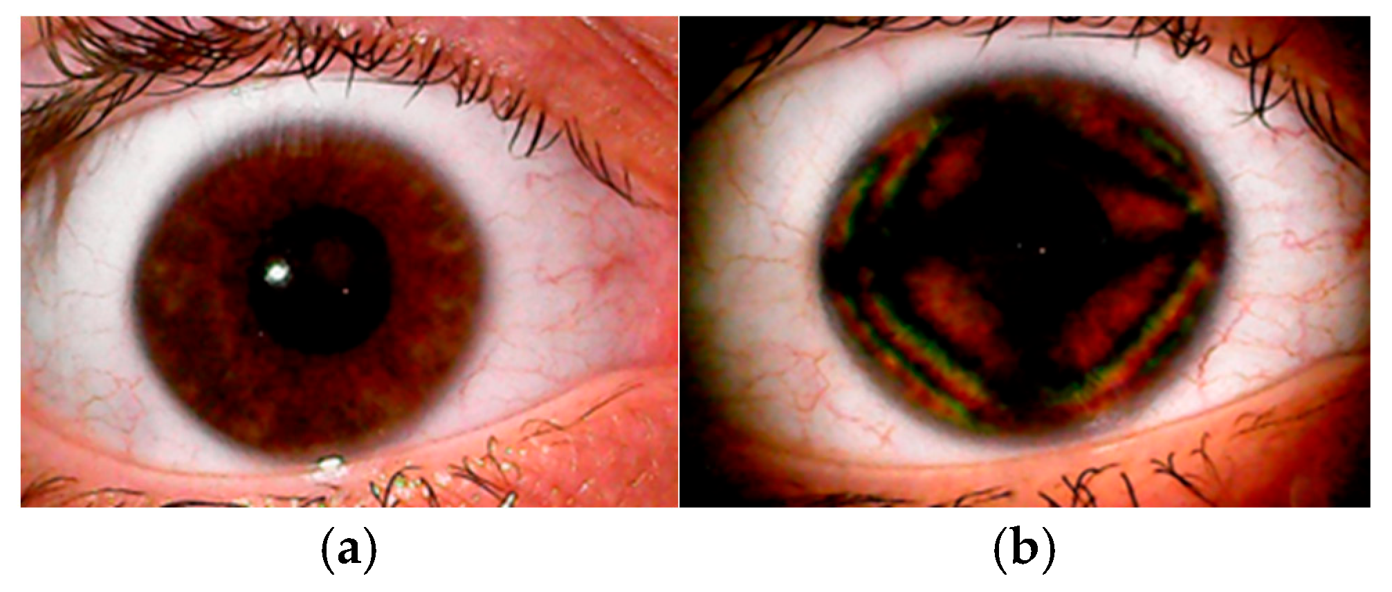 Vision 09 00090 g001 Vision 09 00090 g001