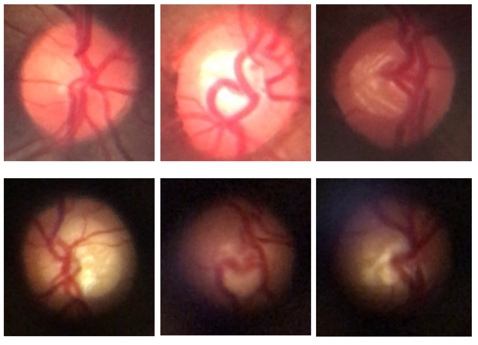 Vision 09 00093 g004