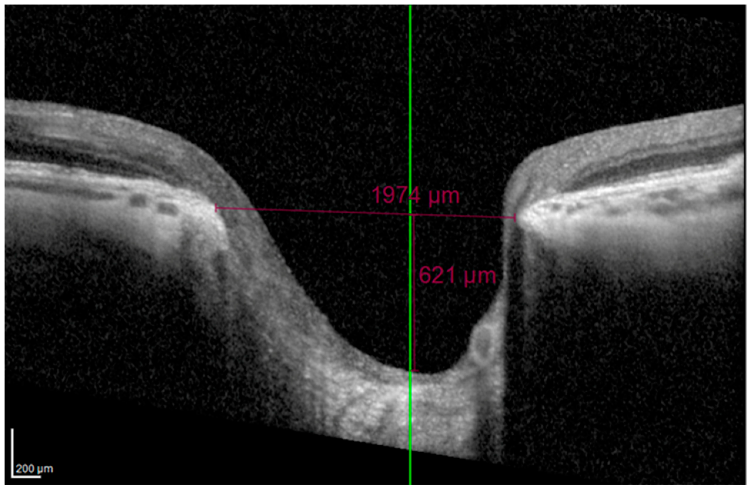 Vision 09 00097 g002