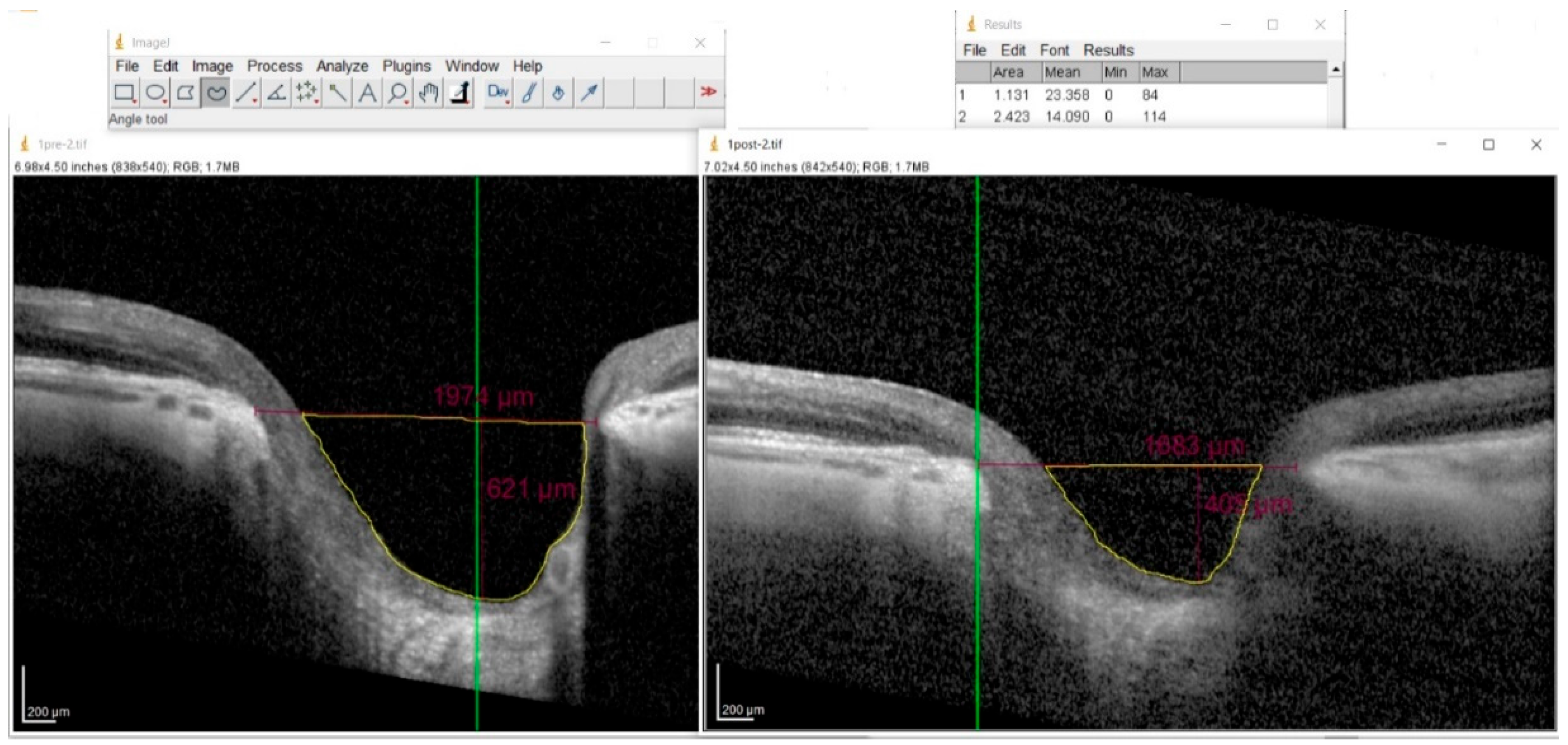 Vision 09 00097 g003