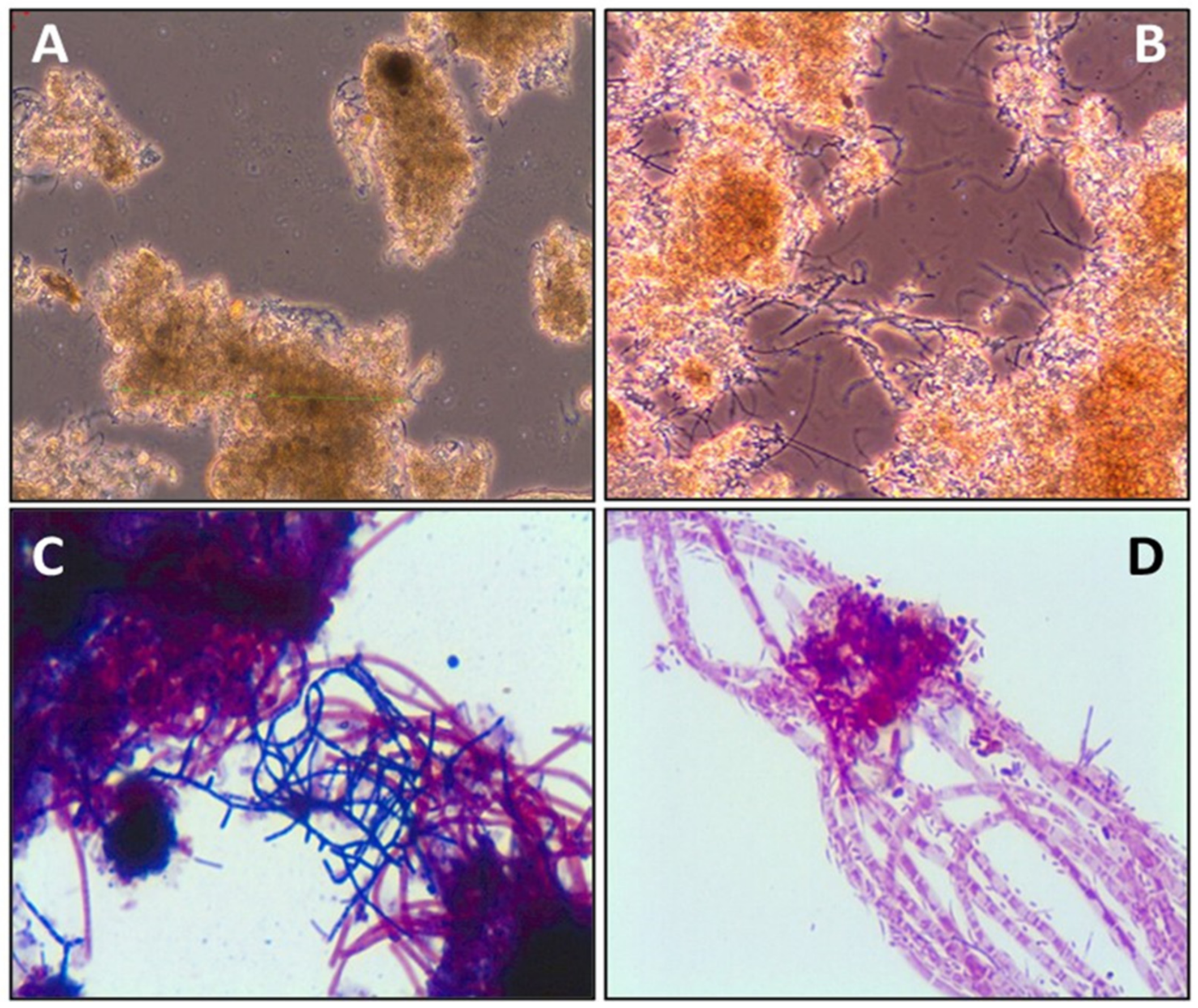 Exam Study Guide: Activated Sludge…