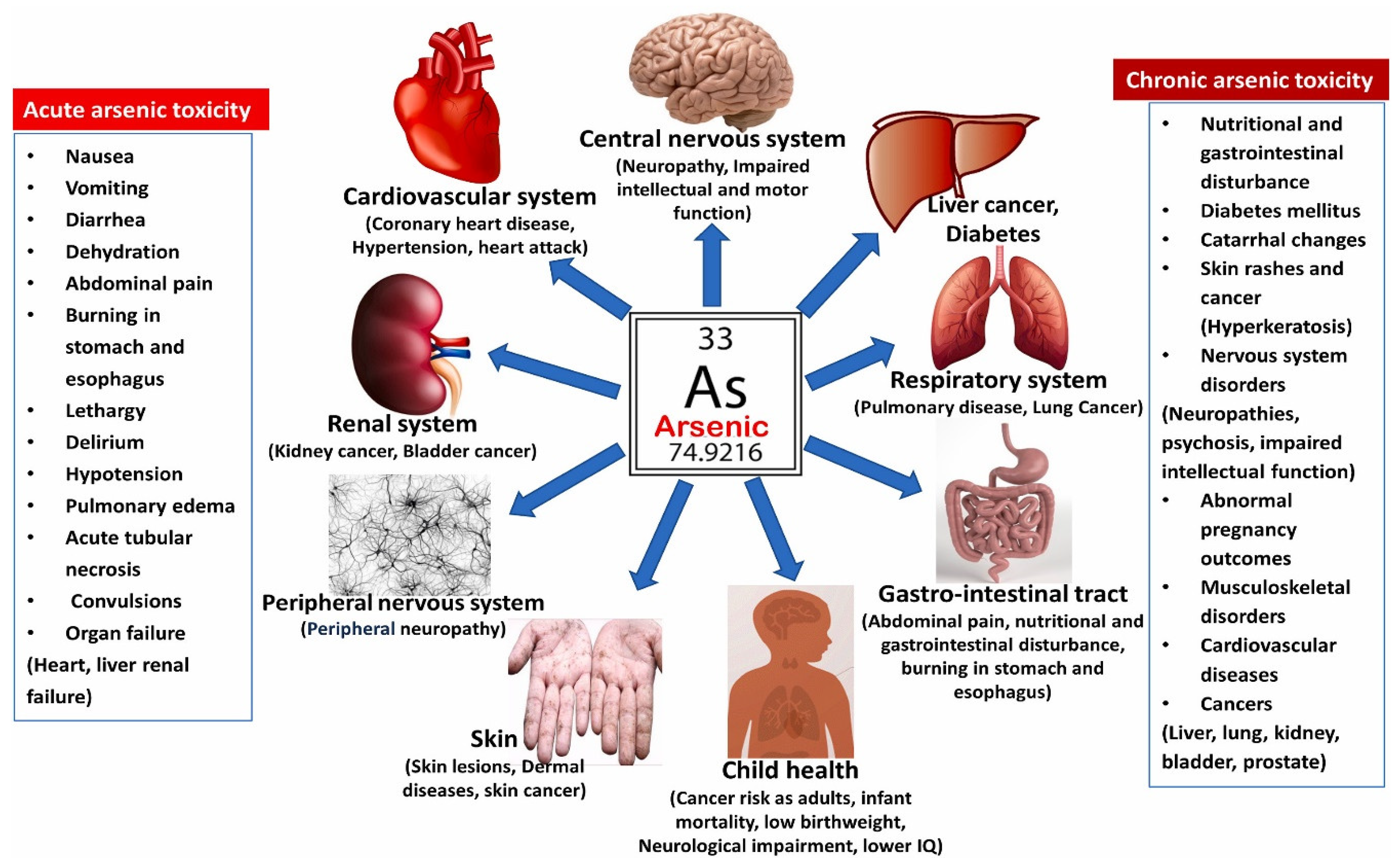 Water 15 00478 g002 Water 15 00478 g002