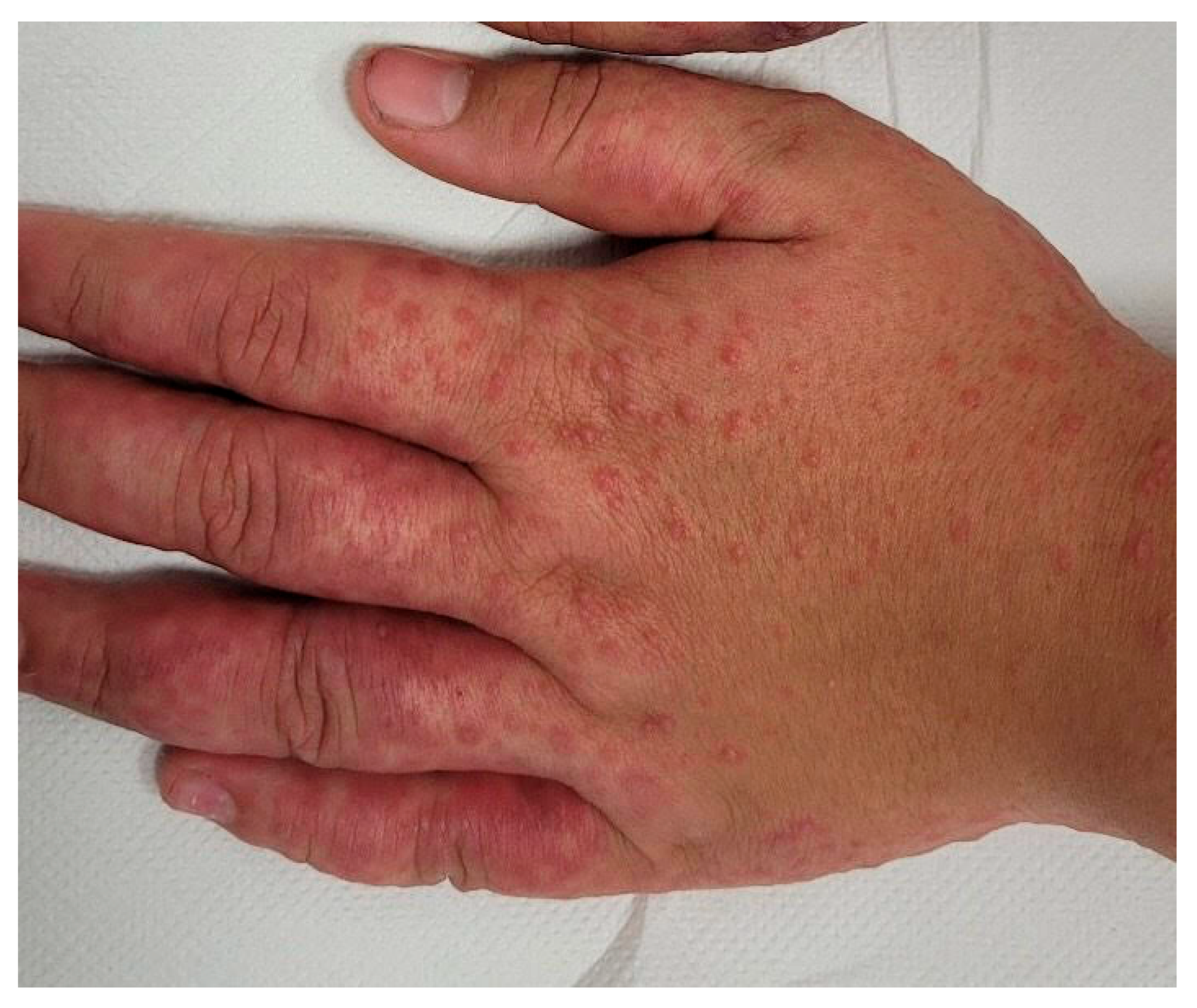 Zoonoticdis 05 00016 g001