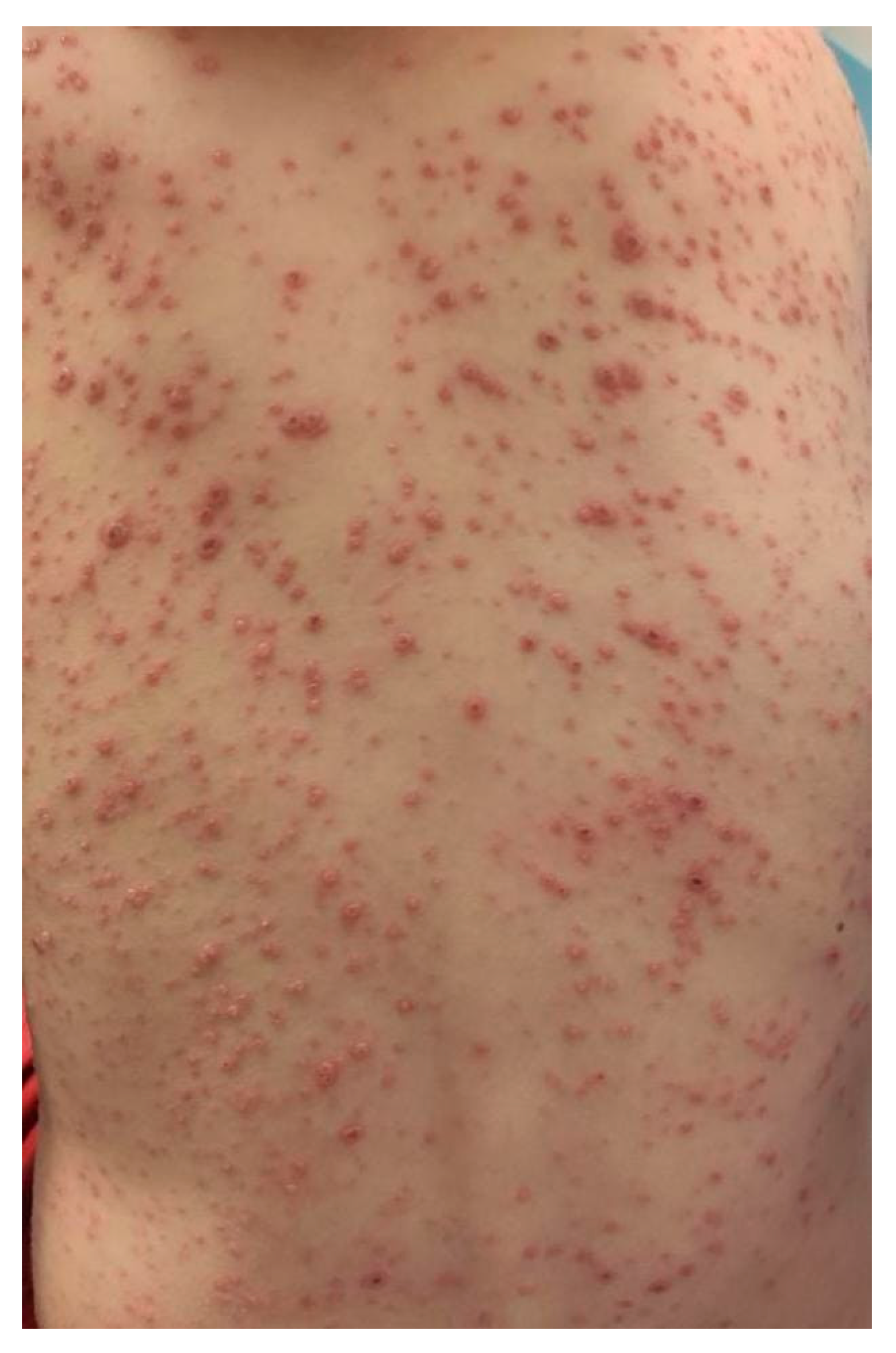 Zoonoticdis 05 00016 g002