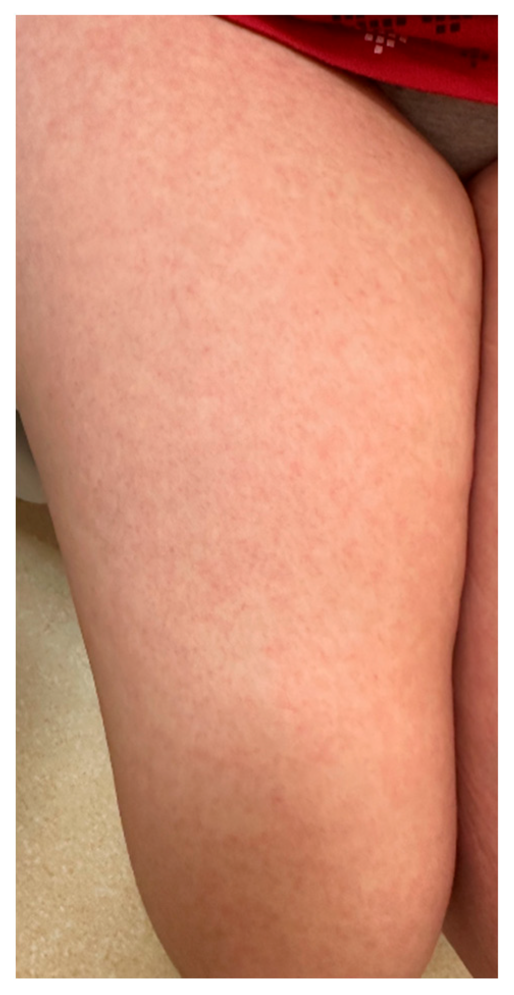 Zoonoticdis 05 00016 g006