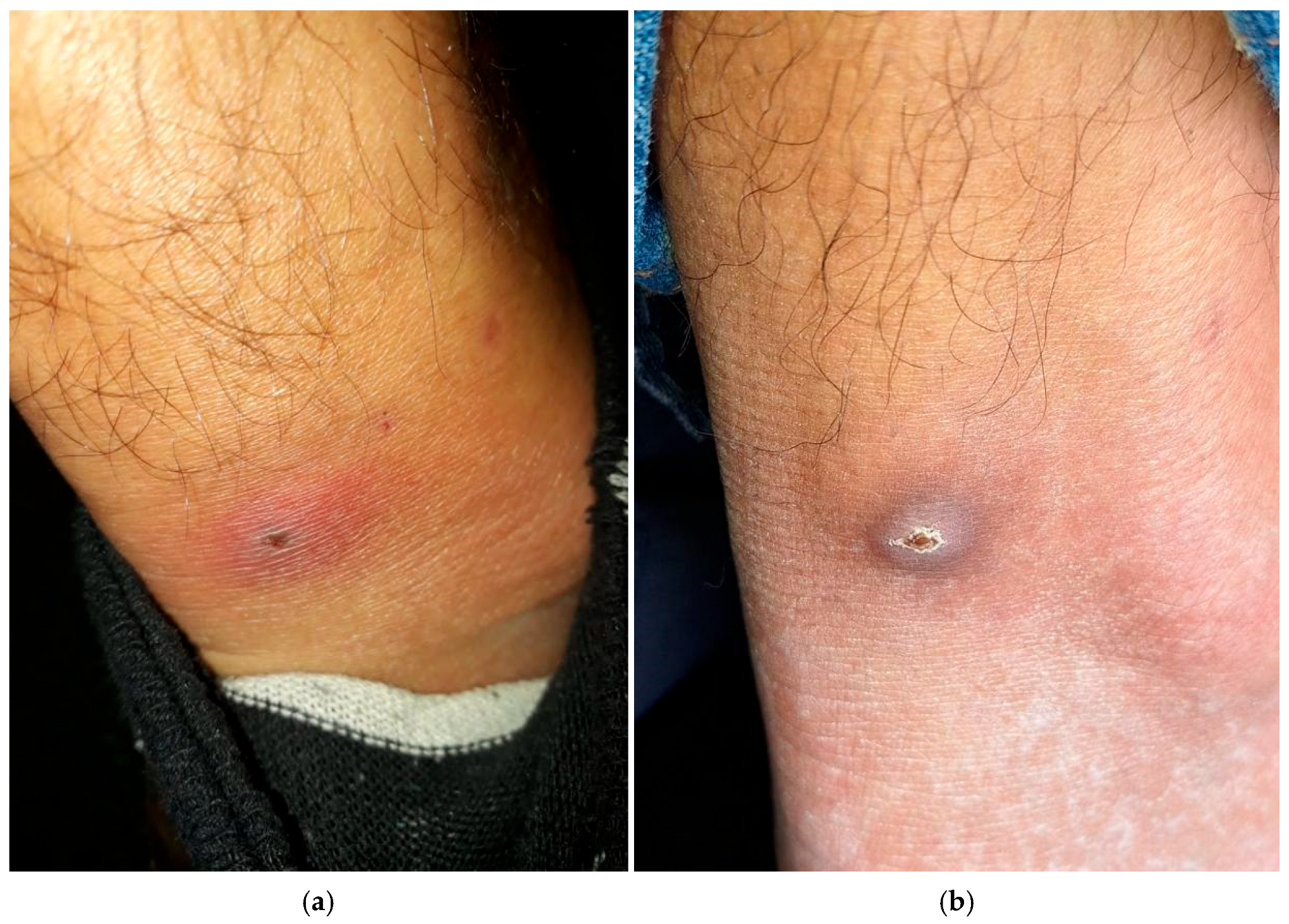 Zoonoticdis 05 00025 g002 Zoonoticdis 05 00025 g002