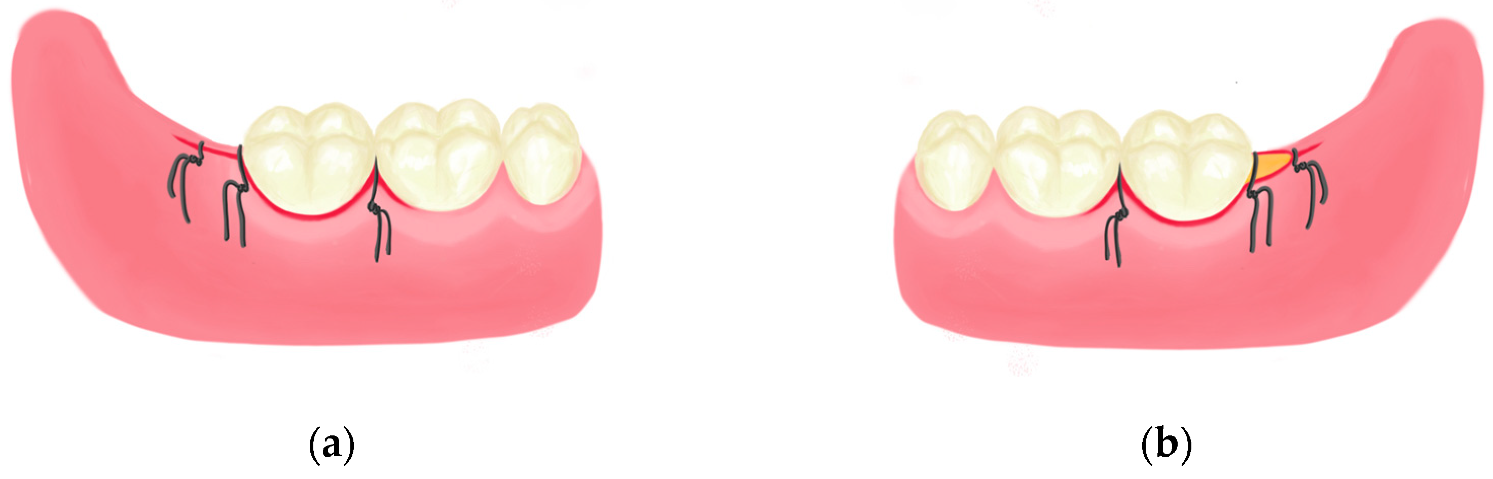 Applsci 14 04228 g001 Applsci 14 04228 g001