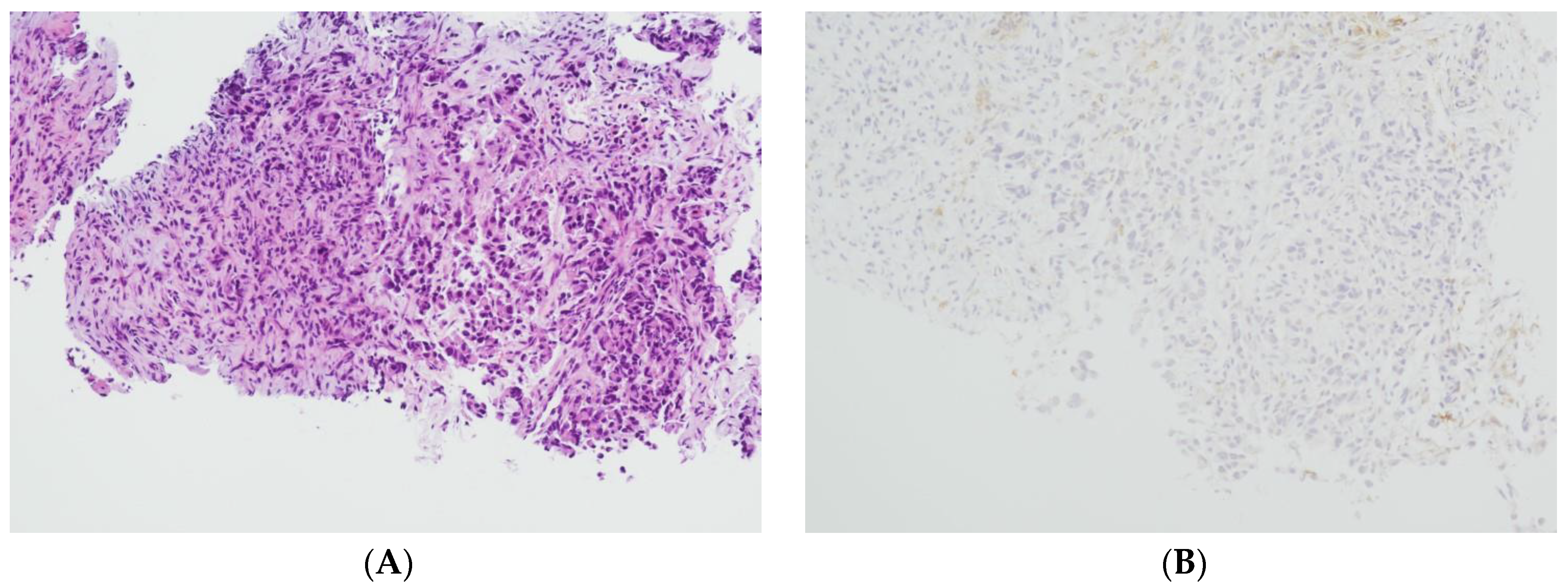 Cancers 16 01841 g003