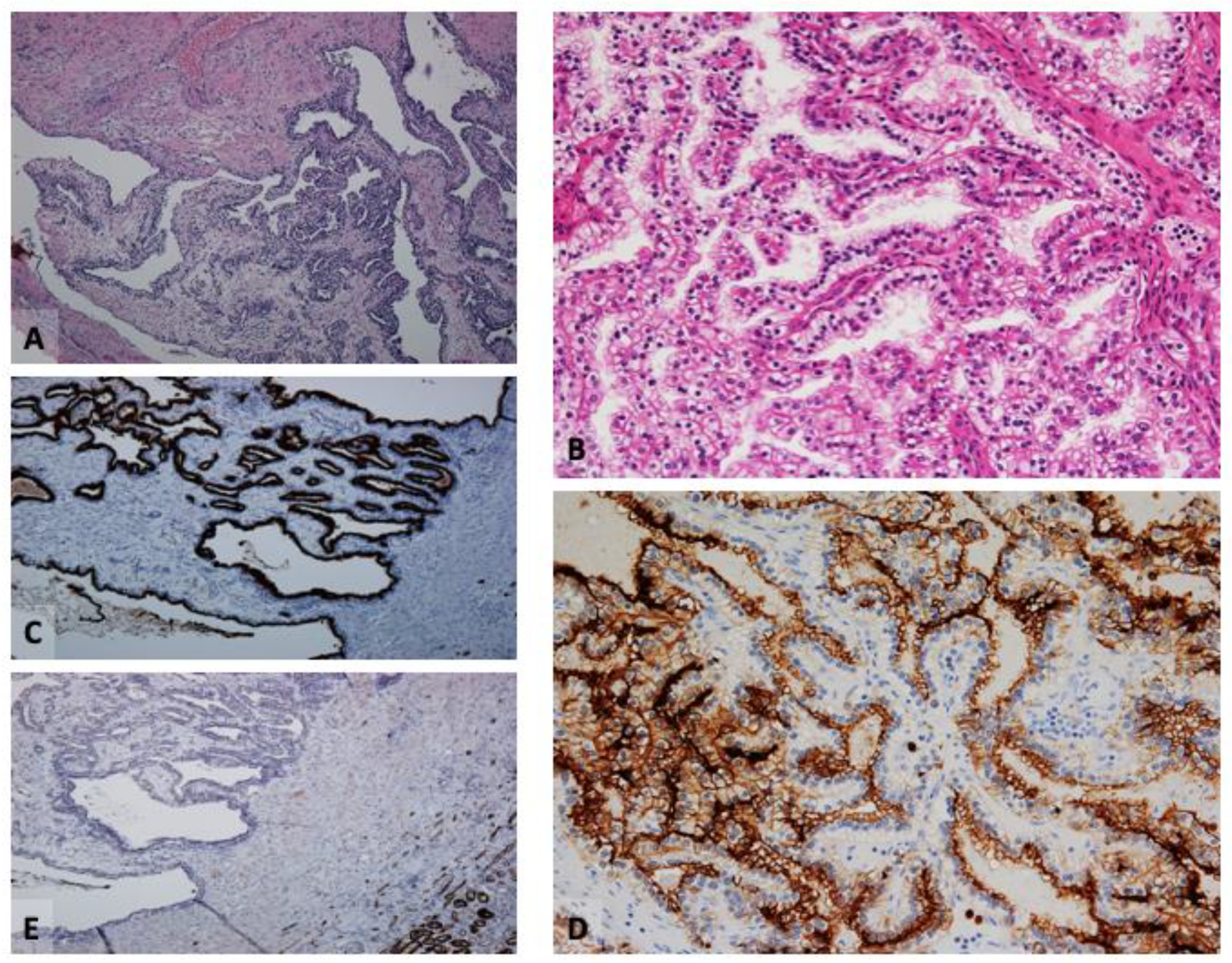 Cancers 16 01856 g001 Cancers 16 01856 g001