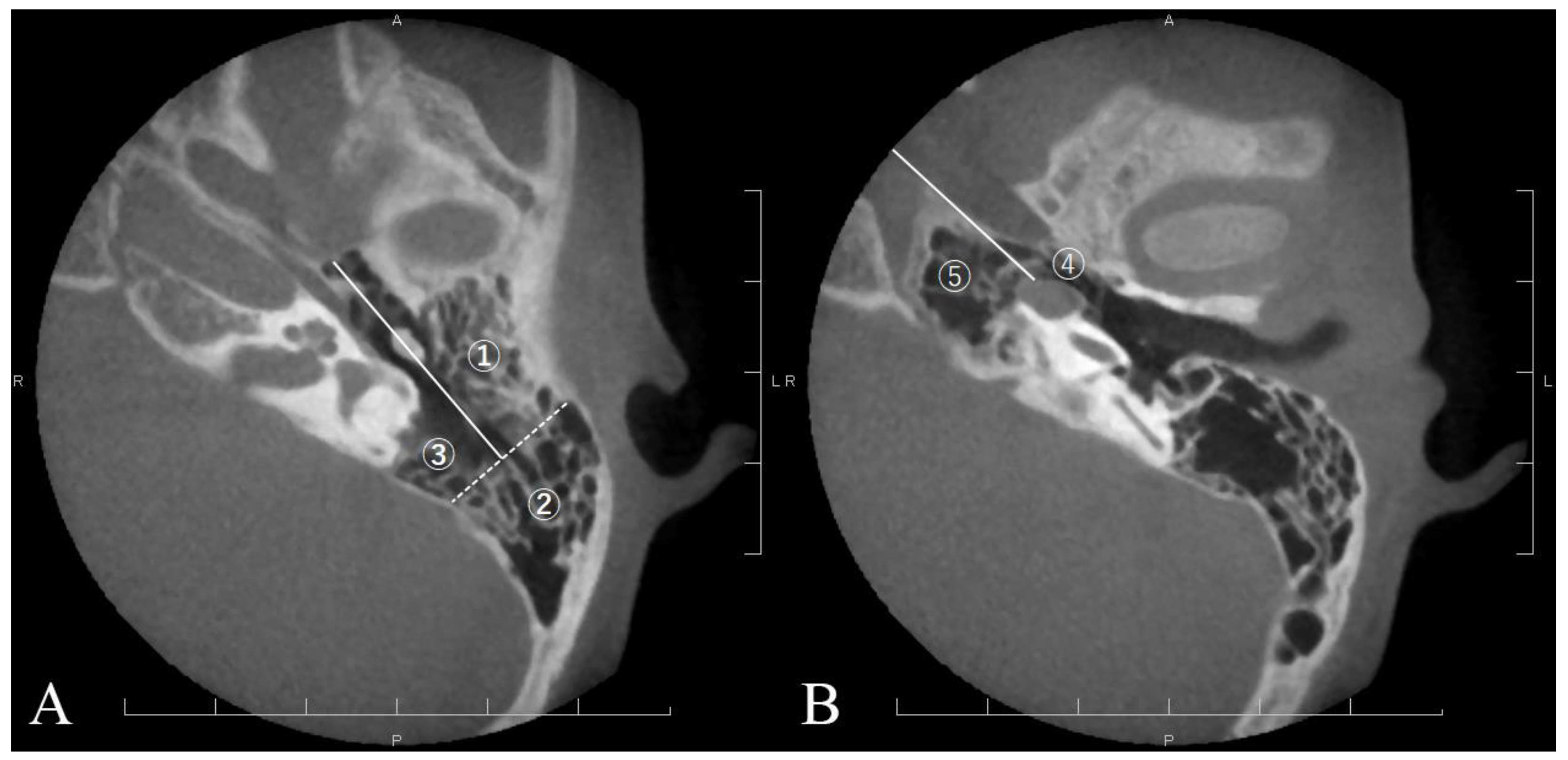 Jcm 13 02934 g001 Jcm 13 02934 g001
