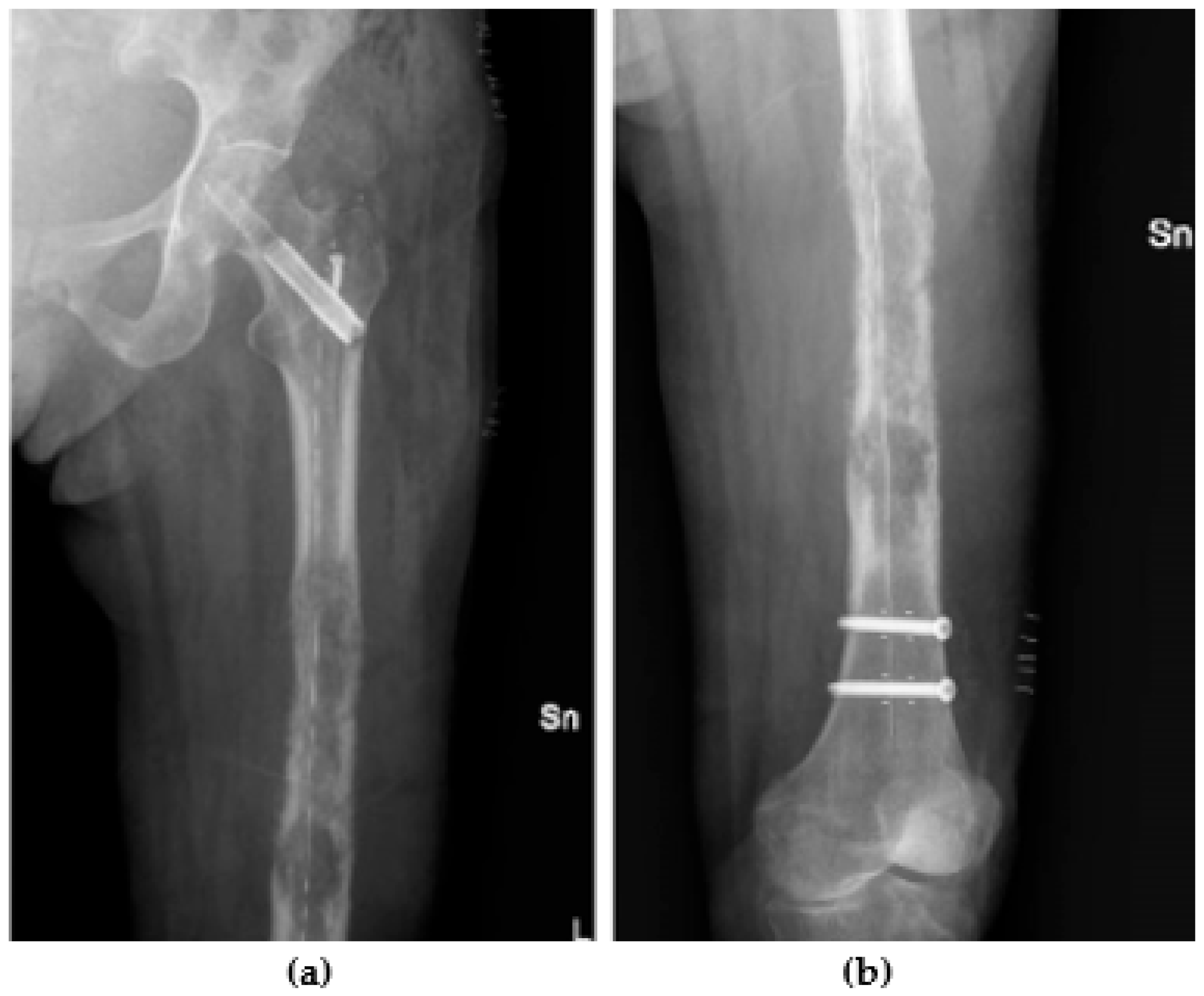 Jcm 13 02940 g002 Jcm 13 02940 g002