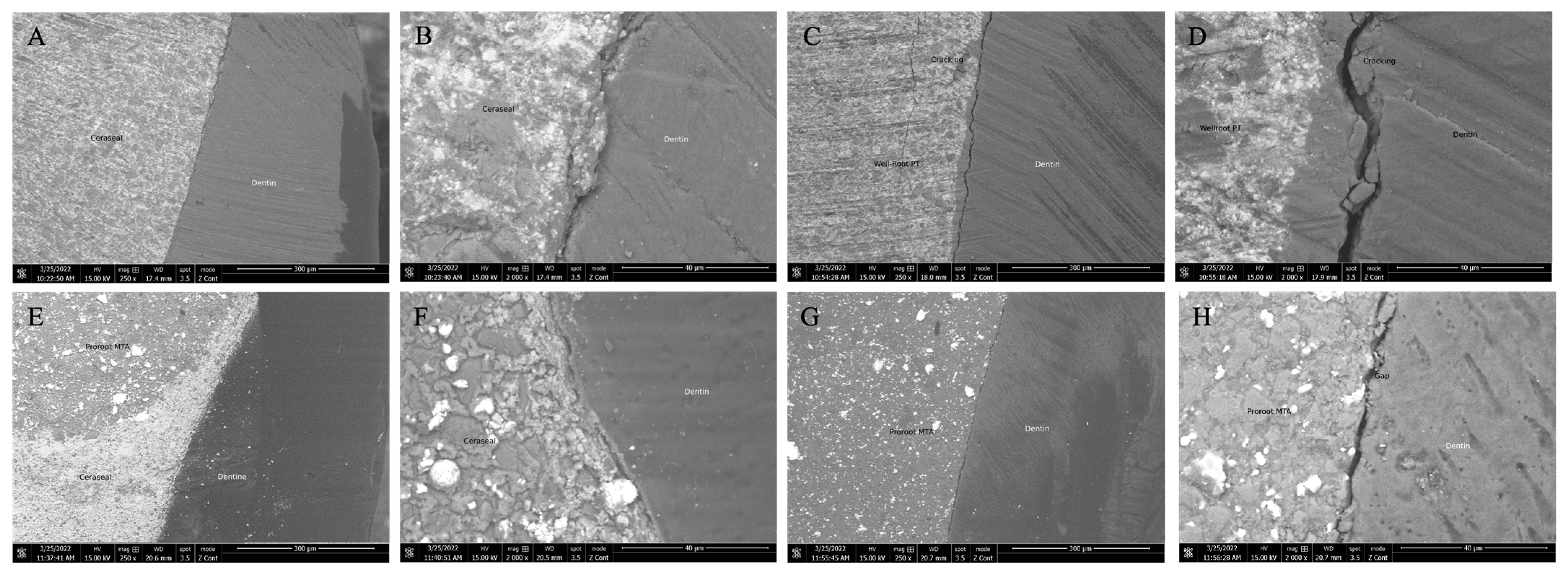 Materials 17 02366 g004